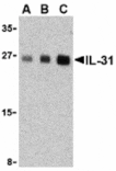 Western blot - IL-31 Antibody from Signalway Antibody (24391) - Antibodies.com