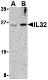 Western blot - IL-32 Antibody from Signalway Antibody (24393) - Antibodies.com