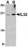 Western blot - IL-32 Antibody from Signalway Antibody (24393) - Antibodies.com