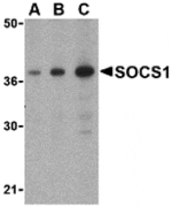 Western blot - SOCS1 Antibody from Signalway Antibody (24399) - Antibodies.com