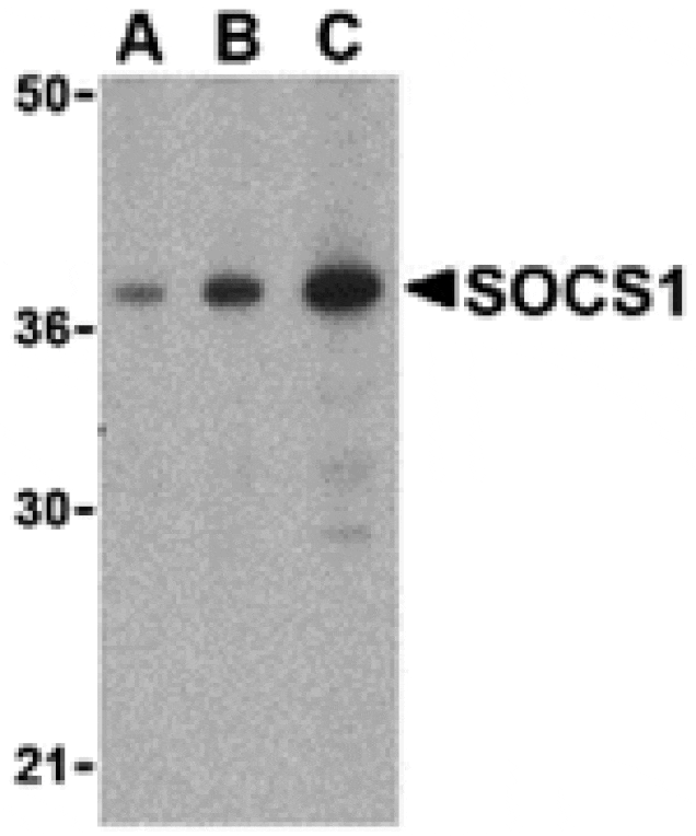 Western blot - SOCS1 Antibody from Signalway Antibody (24399) - Antibodies.com