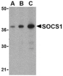 Western blot - SOCS1 Antibody from Signalway Antibody (24399) - Antibodies.com