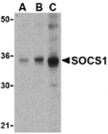 Western blot - SOCS1 Antibody from Signalway Antibody (24400) - Antibodies.com