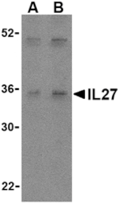 Western blot - IL-27 Antibody from Signalway Antibody (24413) - Antibodies.com