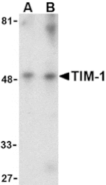 Western blot - TIM-1 Antibody from Signalway Antibody (24417) - Antibodies.com