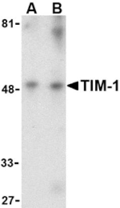 Western blot - TIM-1 Antibody from Signalway Antibody (24417) - Antibodies.com