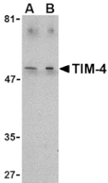 Western blot - TIM-4 Antibody from Signalway Antibody (24418) - Antibodies.com