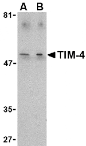 Western blot - TIM-4 Antibody from Signalway Antibody (24418) - Antibodies.com