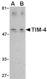 Western blot - TIM-4 Antibody from Signalway Antibody (24418) - Antibodies.com