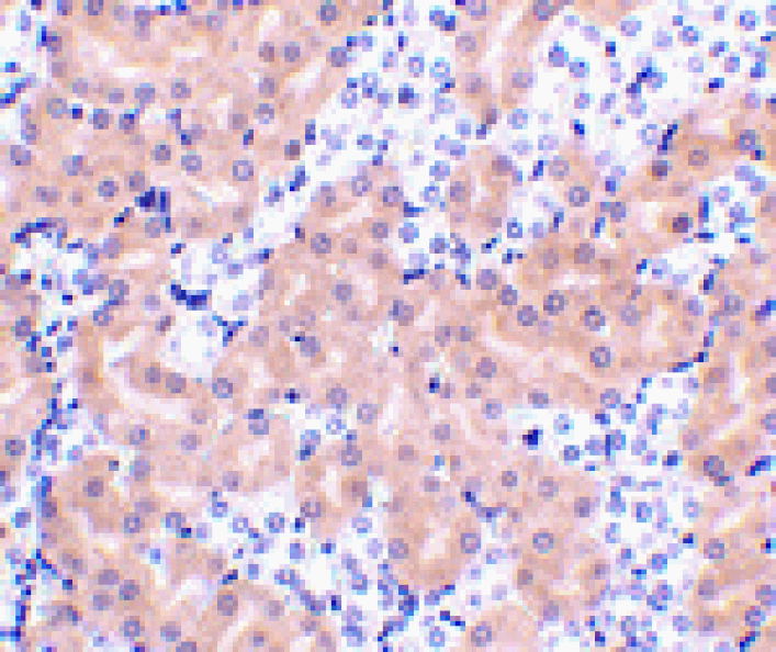 Immunohistochemistry - Bfl-1 Antibody from Signalway Antibody (24436) - Antibodies.com