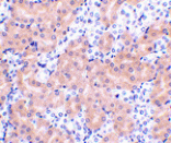 Immunohistochemistry - Bfl-1 Antibody from Signalway Antibody (24436) - Antibodies.com