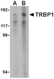 Western blot - TRBP1 Antibody from Signalway Antibody (24481) - Antibodies.com