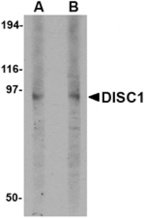 Western blot - DISC1 Antibody from Signalway Antibody (24561) - Antibodies.com