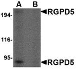 Western blot analysis of RGPD5 in human thymus tissue lysate with RGPD5 antibody at 1 µg/mL in (A) the absence and (B) the presence of blocking peptide.