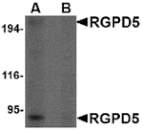 Western blot - RGPD5 Antibody from Signalway Antibody (24675) - Antibodies.com