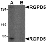 Western blot - RGPD5 Antibody from Signalway Antibody (24675) - Antibodies.com