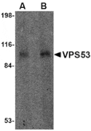 Western blot - VPS53 Antibody from Signalway Antibody (24679) - Antibodies.com