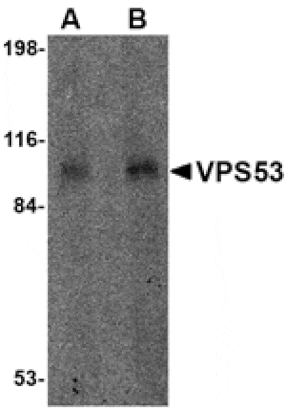 Western blot - VPS53 Antibody from Signalway Antibody (24679) - Antibodies.com