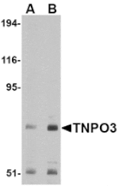 Western blot - TNPO3 Antibody from Signalway Antibody (24680) - Antibodies.com