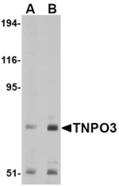 Western blot - TNPO3 Antibody from Signalway Antibody (24680) - Antibodies.com