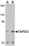 Western blot - TNPO3 Antibody from Signalway Antibody (24680) - Antibodies.com