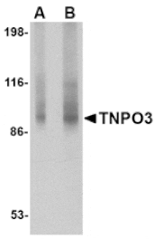 Western blot - TNPO3 Antibody from Signalway Antibody (24681) - Antibodies.com