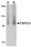 Western blot - TNPO3 Antibody from Signalway Antibody (24681) - Antibodies.com