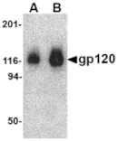 Western blot - gp120 Antibody from Signalway Antibody (24700) - Antibodies.com