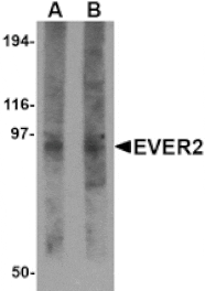 Western blot - EVER2 Antibody from Signalway Antibody (24707) - Antibodies.com