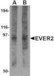 Western blot - EVER2 Antibody from Signalway Antibody (24707) - Antibodies.com