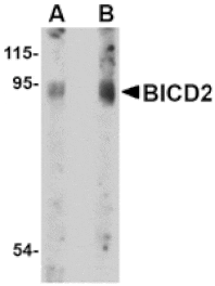 Western blot - BICD2 Antibody from Signalway Antibody (24711) - Antibodies.com