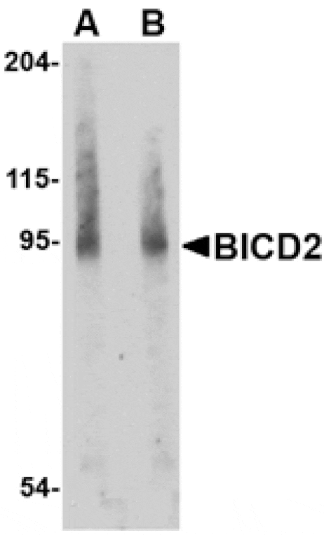 Western blot - BICD2 Antibody from Signalway Antibody (24712) - Antibodies.com