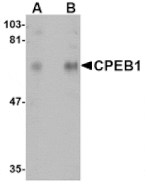 Western blot - CPEB1 Antibody from Signalway Antibody (24716) - Antibodies.com