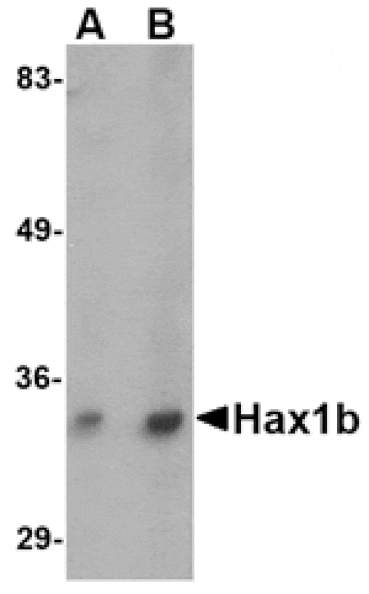 Western blot - Hax1b Antibody from Signalway Antibody (24725) - Antibodies.com