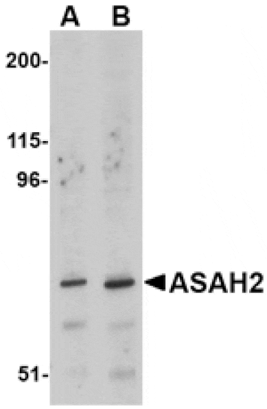Western blot - ASAH2 Antibody from Signalway Antibody (24731) - Antibodies.com