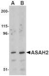 Western blot - ASAH2 Antibody from Signalway Antibody (24731) - Antibodies.com