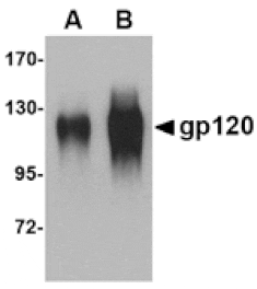 Western blot - gp120 Antibody from Signalway Antibody (24745) - Antibodies.com
