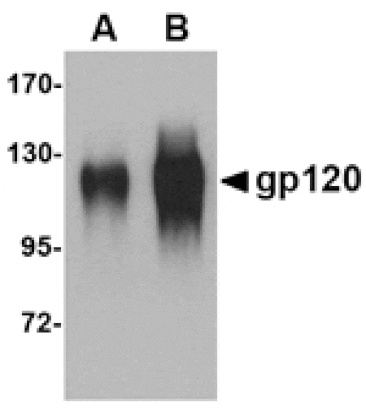 Western blot - gp120 Antibody from Signalway Antibody (24745) - Antibodies.com