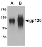 Western blot - gp120 Antibody from Signalway Antibody (24745) - Antibodies.com