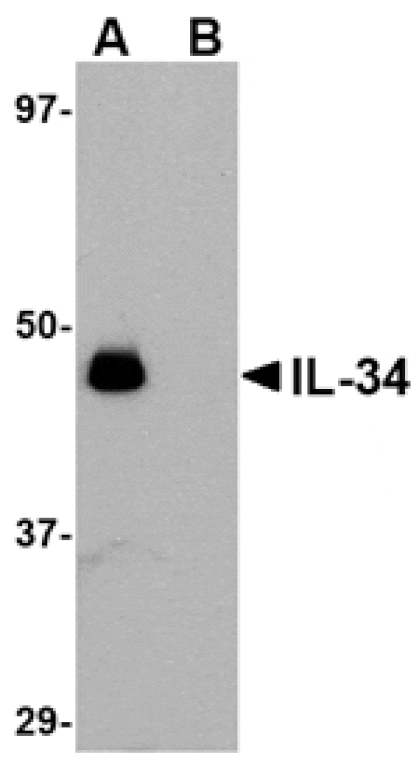 Western blot - IL-34 Antibody from Signalway Antibody (24746) - Antibodies.com