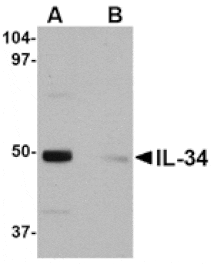 Western blot - IL-34 Antibody from Signalway Antibody (24747) - Antibodies.com