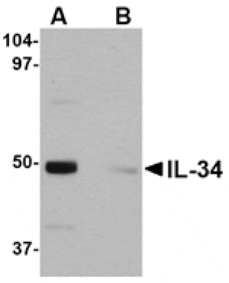 Western blot - IL-34 Antibody from Signalway Antibody (24747) - Antibodies.com
