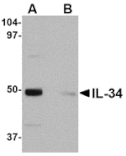 Western blot - IL-34 Antibody from Signalway Antibody (24747) - Antibodies.com