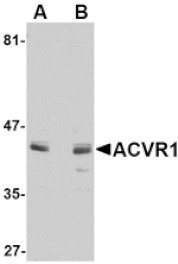 Western blot - ACVR1 Antibody from Signalway Antibody (24751) - Antibodies.com