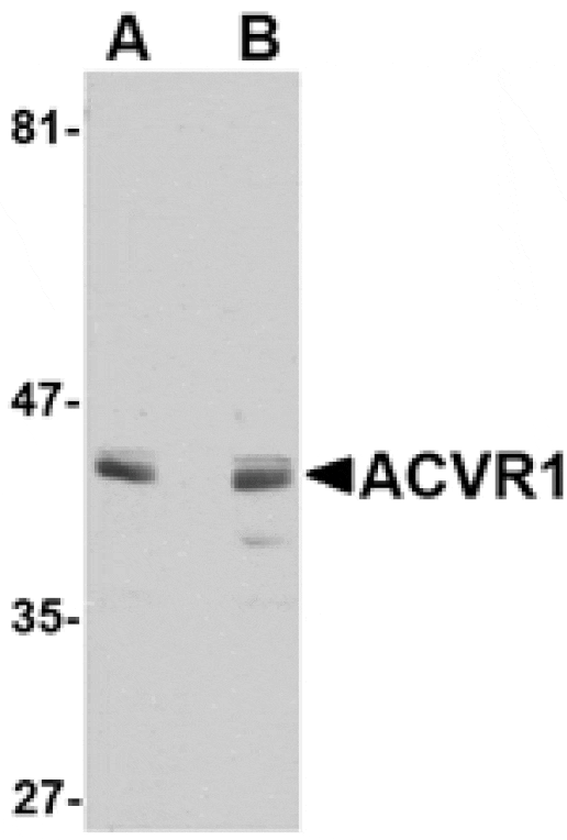 Western blot - ACVR1 Antibody from Signalway Antibody (24751) - Antibodies.com