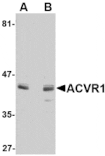 Western blot - ACVR1 Antibody from Signalway Antibody (24751) - Antibodies.com