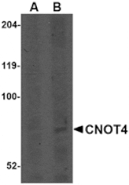 Western blot - CNOT4 Antibody from Signalway Antibody (24762) - Antibodies.com