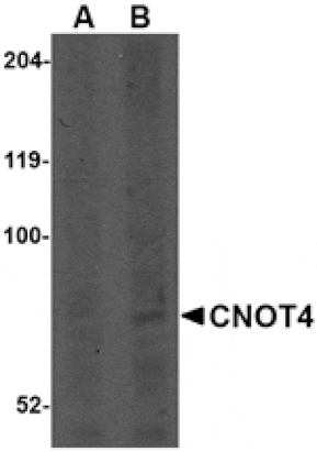 Western blot - CNOT4 Antibody from Signalway Antibody (24762) - Antibodies.com