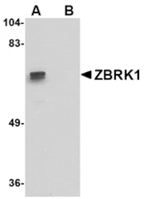 Western blot - ZBRK1 Antibody from Signalway Antibody (24764) - Antibodies.com