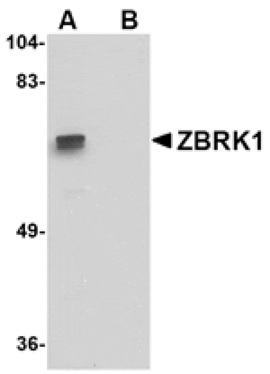Western blot - ZBRK1 Antibody from Signalway Antibody (24764) - Antibodies.com